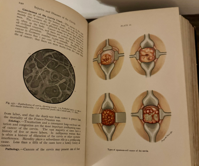 1905 A Text-Book of Diseases of Women by Dr. Barton Cooke Hirst – Second Edition